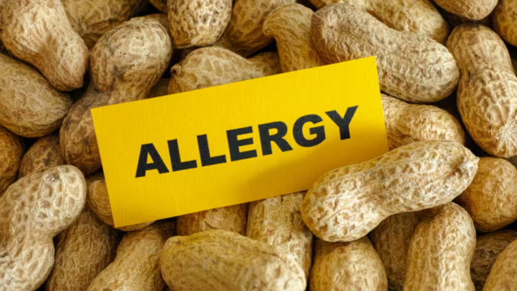 Peanut allergy. Conceptual image. Source: iStockphoto - Getty Images